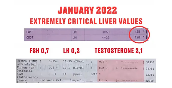 Maximilian Egger vor der Transformation - Bluttest-Analyse